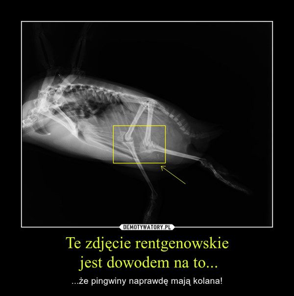 Te zdjęcie rentgenowskie jest dowodem na to... – ...że pingwiny naprawdę mają kolana! 