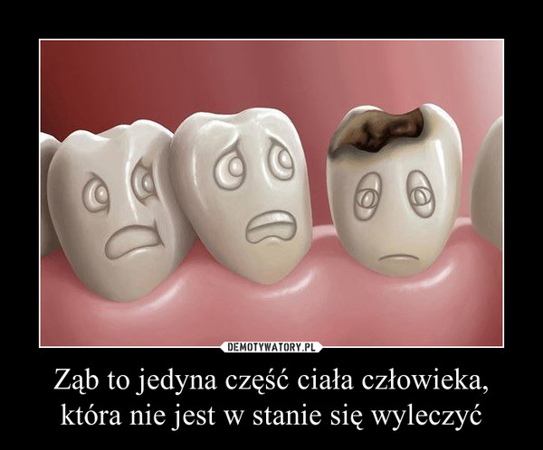 Ząb to jedyna część ciała człowieka, która nie jest w stanie się wyleczyć –  
