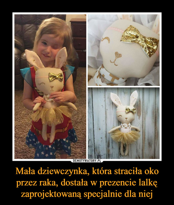 Mała dziewczynka, która straciła oko przez raka, dostała w prezencie lalkę zaprojektowaną specjalnie dla niej –  