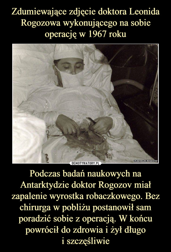 Zdumiewające zdjęcie doktora Leonida Rogozowa wykonującego na sobie operację w 1967 roku Podczas badań naukowych na Antarktydzie doktor Rogozov miał zapalenie wyrostka robaczkowego. Bez chirurga w pobliżu postanowił sam poradzić sobie z operacją. W końcu powrócił do zdrowia i żył długo
i szczęśliwie