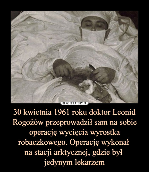 30 kwietnia 1961 roku doktor Leonid Rogożów przeprowadził sam na sobie
operację wycięcia wyrostka robaczkowego. Operację wykonał 
na stacji arktycznej, gdzie był 
jedynym lekarzem